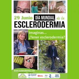 Chipiona visibiliza hoy 29 de junio la enfermedad de la Esclerodermia